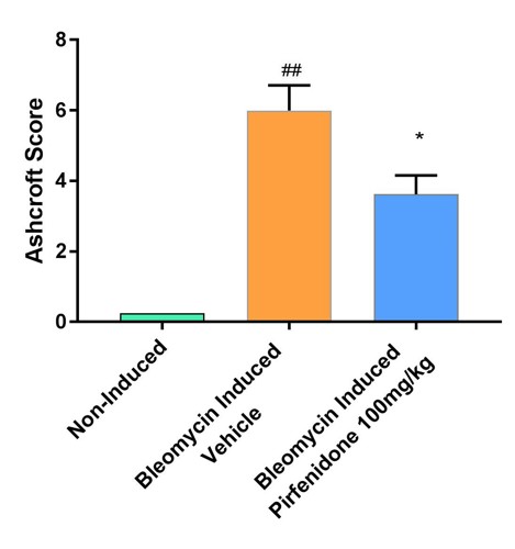 Idiopathic Pulmonary Fibrosis study