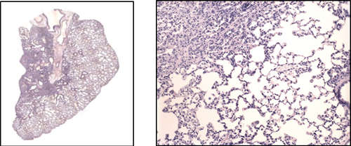 Bleomycin-induced Pirfenidrone 100mg/kg QD