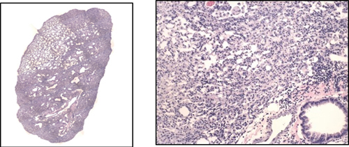 Bleomycin-induced Vehicle